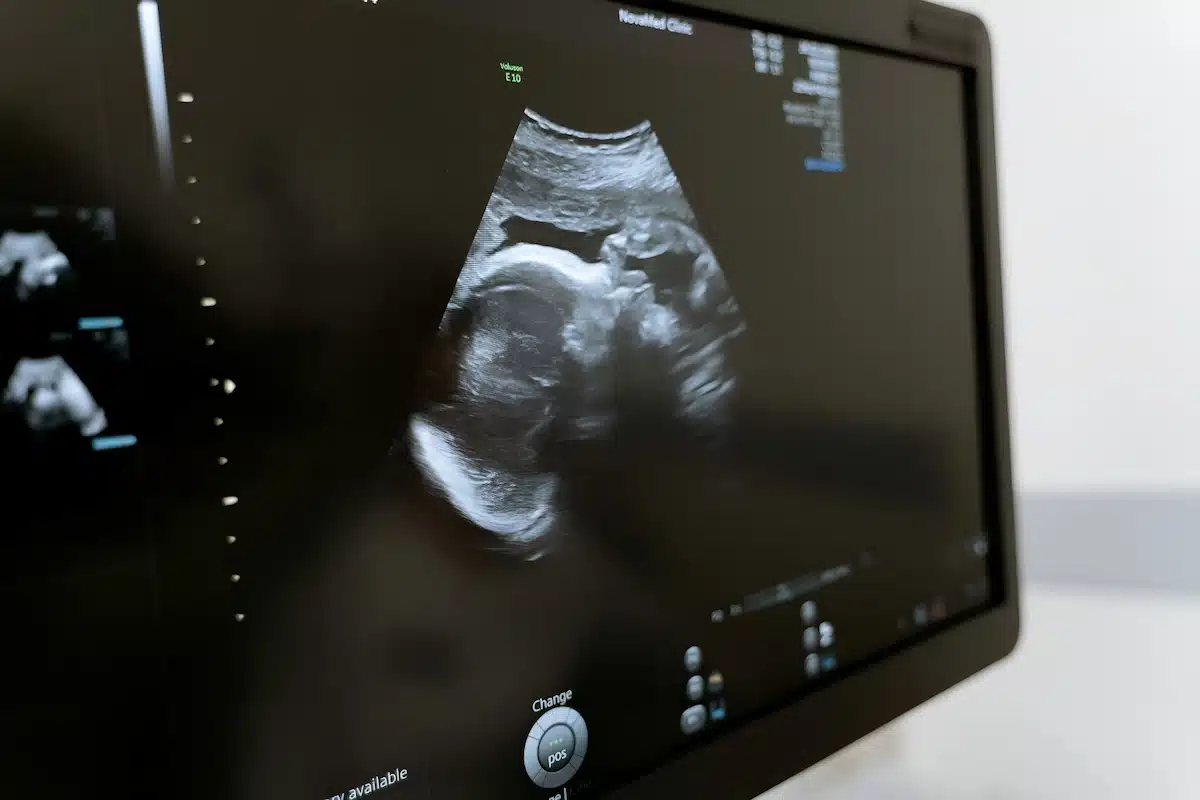 How Your Baby’s Brain Grows - fetal brain development